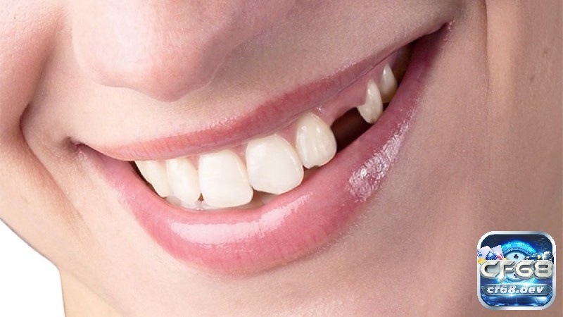 Giấc mơ bị gãy răng cửa thường phản ánh sự bất an về hình ảnh bản thân hoặc những áp lực trong các mối quan hệ xã hội mà bạn muốn cải thiện.
